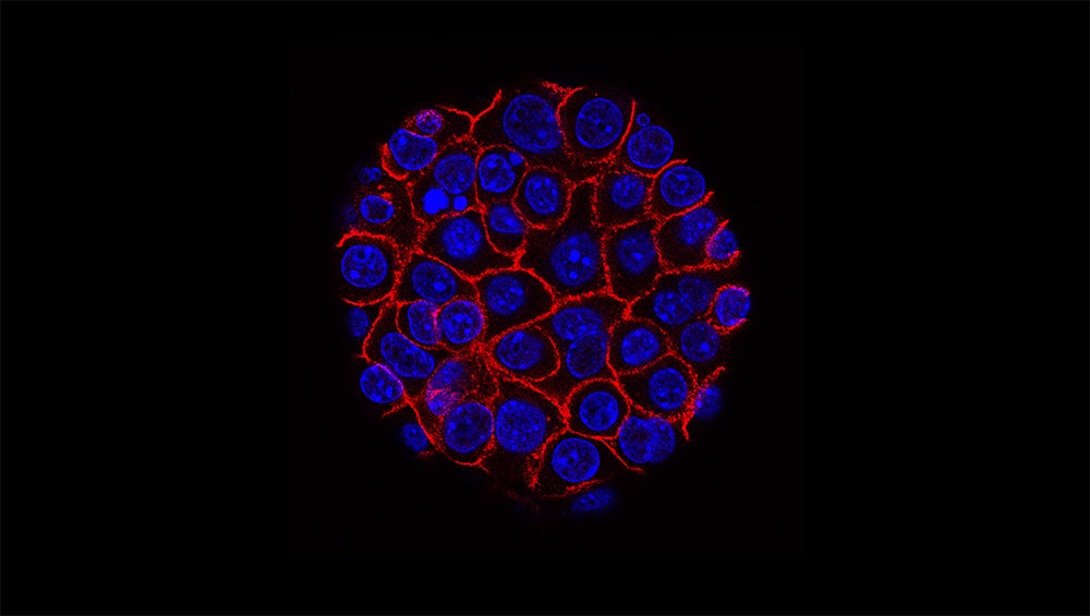 A pancreatic cancer cell