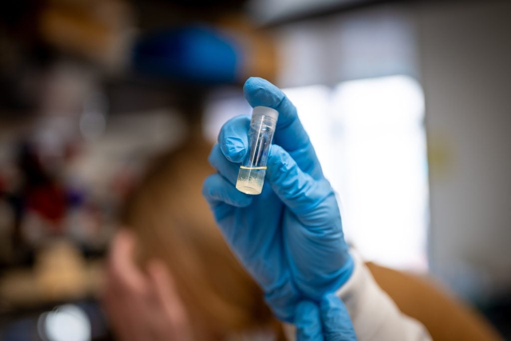 Knope examines a vial in a lab